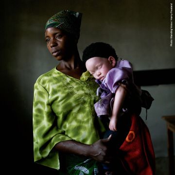 A mother and her daughter with albinism standing together.
Photo by Standing Voice / Harry Freeland