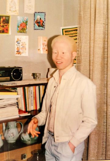 A young person with albinism stands indoors beside a bookshelf, smiling, with postcards and decorations on the wall behind them.
