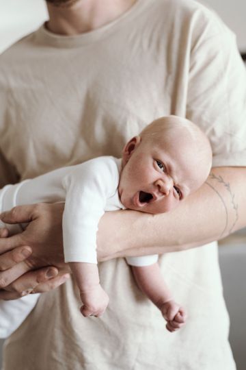 Portrait of a newborn child with albinism.