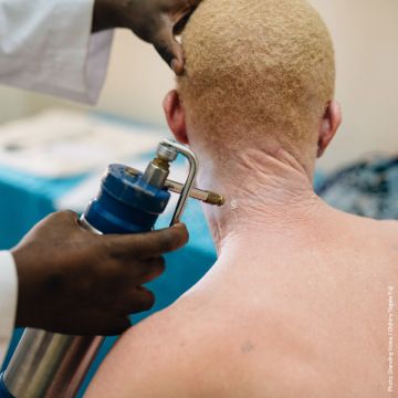 Skin cancer treatment on a young man.
Photo by Standing Voice / Chihiro Tagata Fuji.